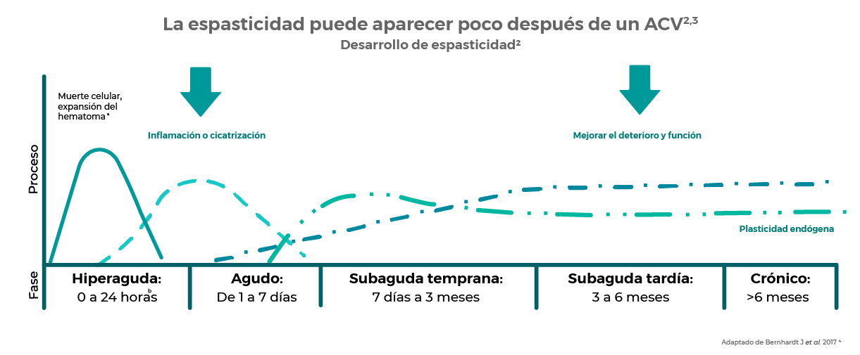 Espasticidad Espasticidad