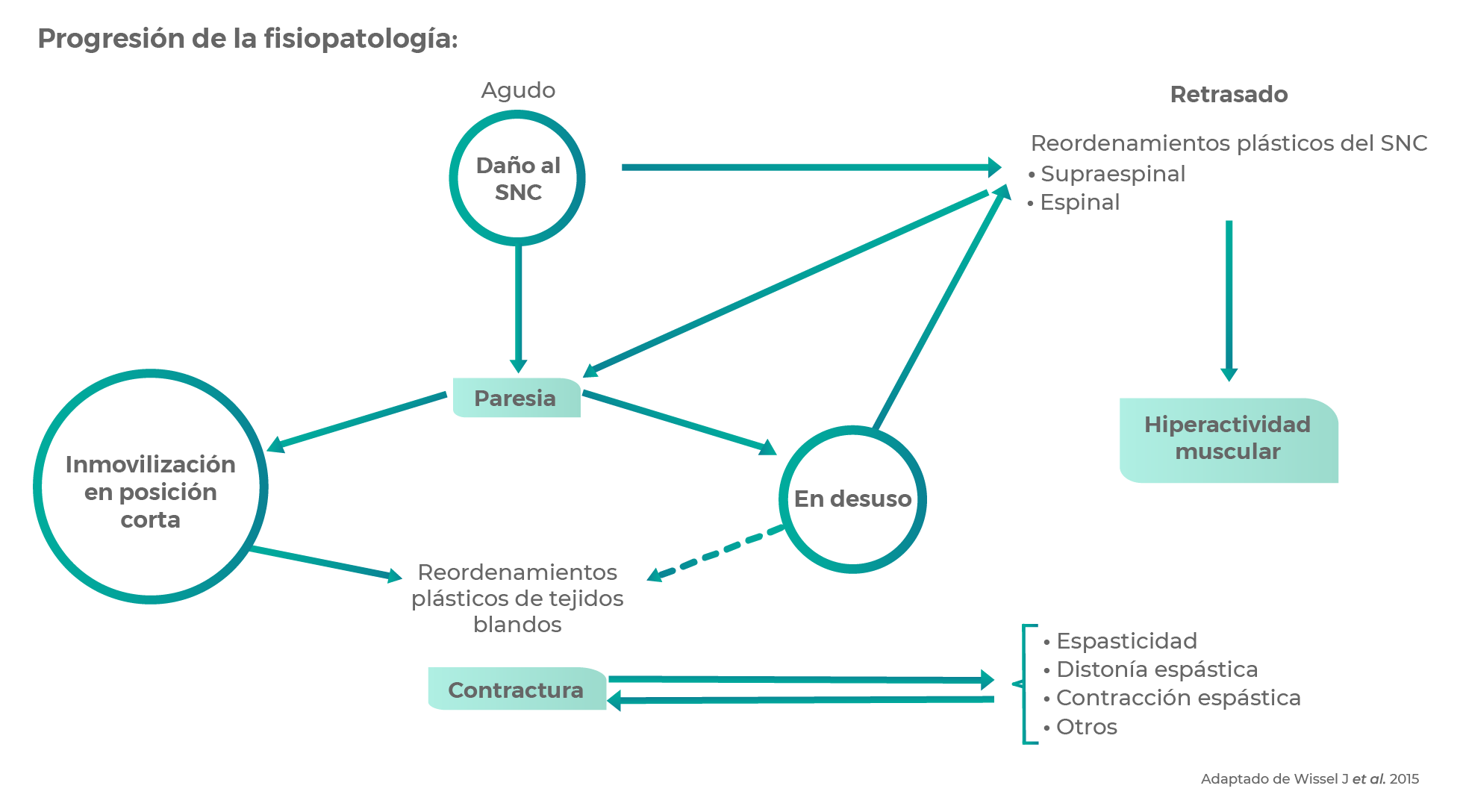 Espasticidad Espasticidad