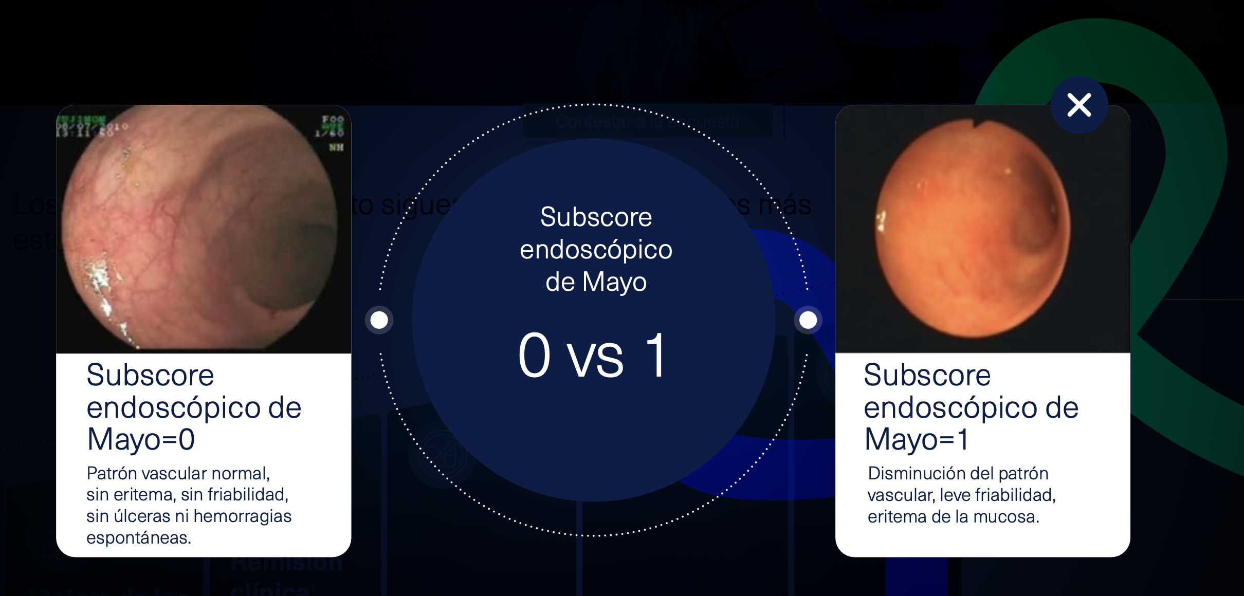 subcore-endoscopico