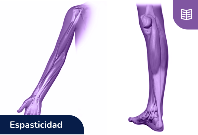 Botox para tratar la espasticidad