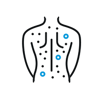 Visuals eines Rückens mit Punkten, die Entzünden darstellen sollen