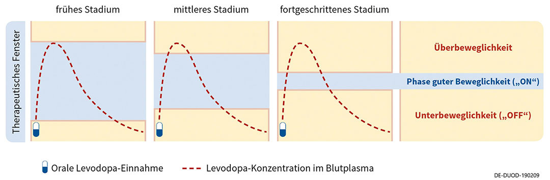Therapeutisches Fenster zur Darstellung von Wirkschwankungen unter oraler Therapie von Morbus Parkinson