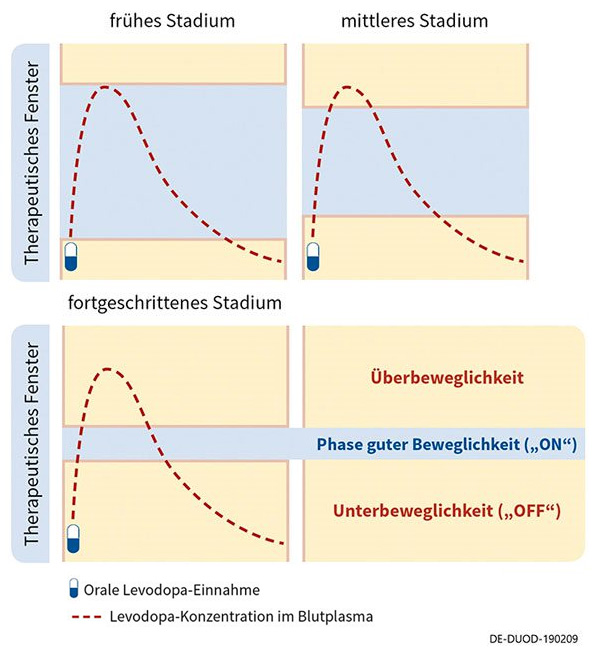 Therapeutisches Fenster zur Darstellung von Wirkschwankungen unter oraler Therapie von Morbus Parkinson