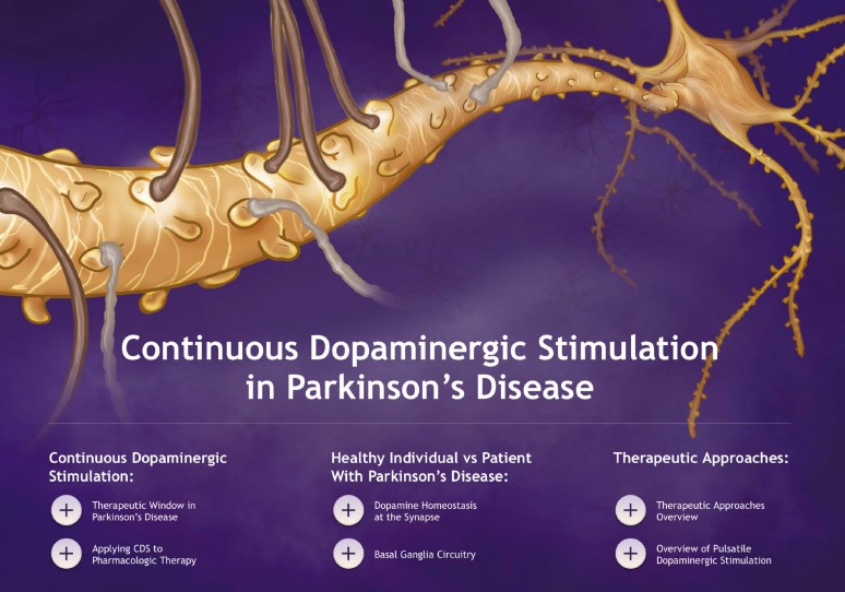 Continuous Dopaminergic Stimulation IMA