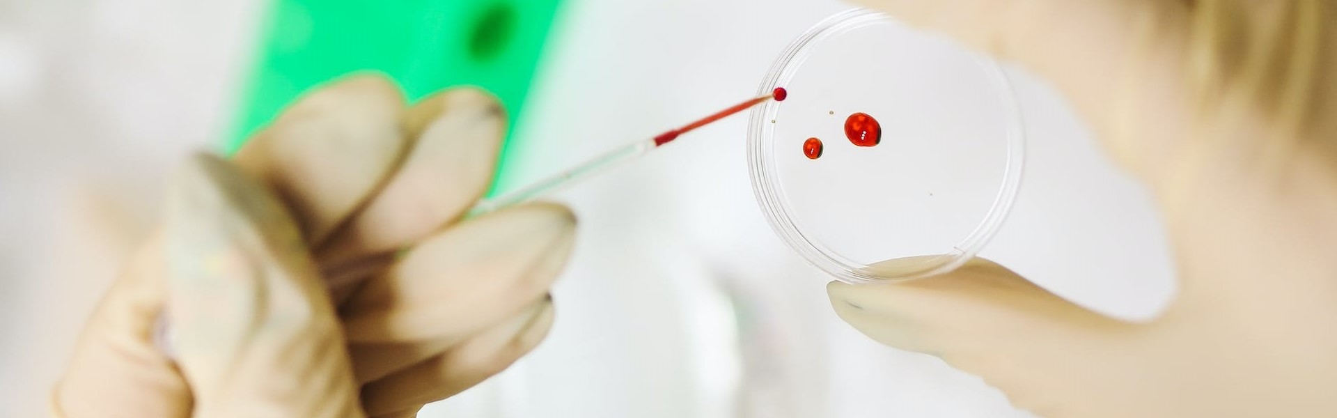 Untersuchung einer Blutprobe.