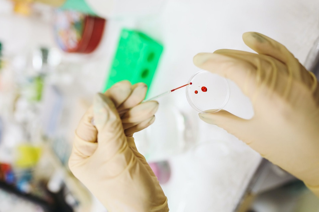 Untersuchung einer Blutprobe.