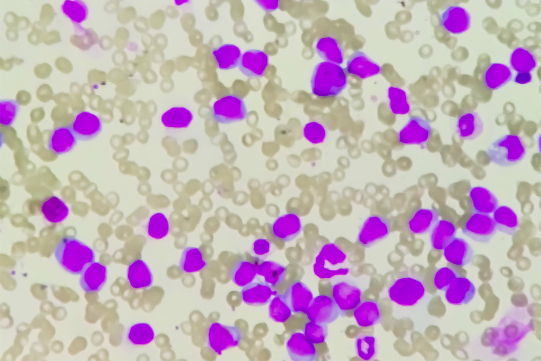 AML Ansicht Mikroskop