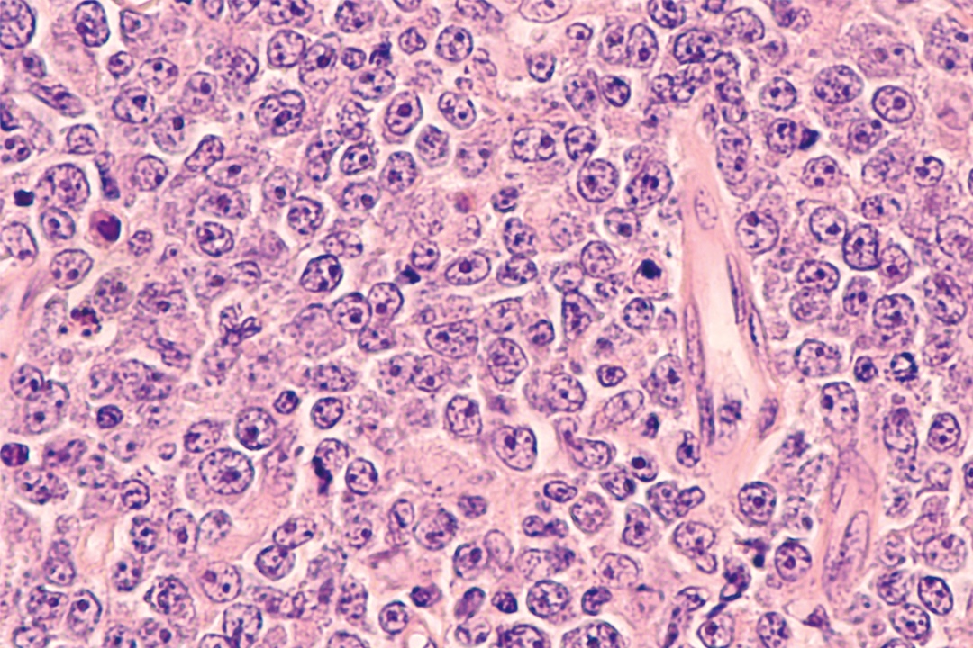 CLL Ansicht Mikroskop