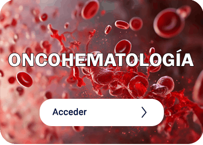 Ir a oncohematología