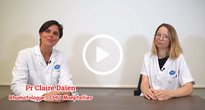 Diagnostiquer plus précisément les maladies inflammatoires rhumatologiques – expérience du CHU de Montpellier