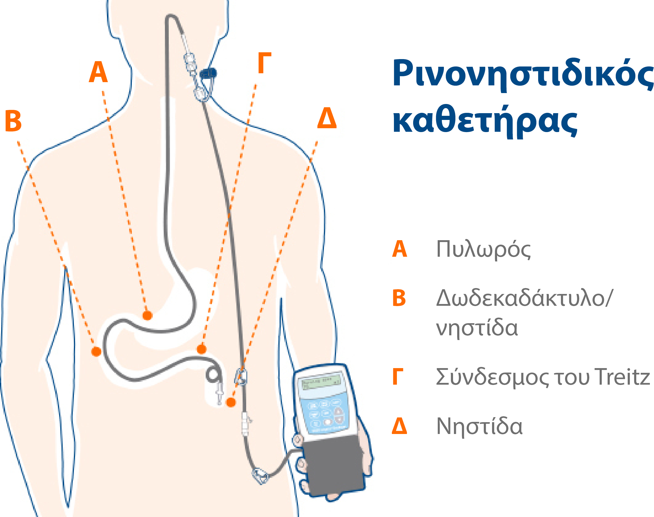 Duodopa_AbbVie_Pro_Graphs30