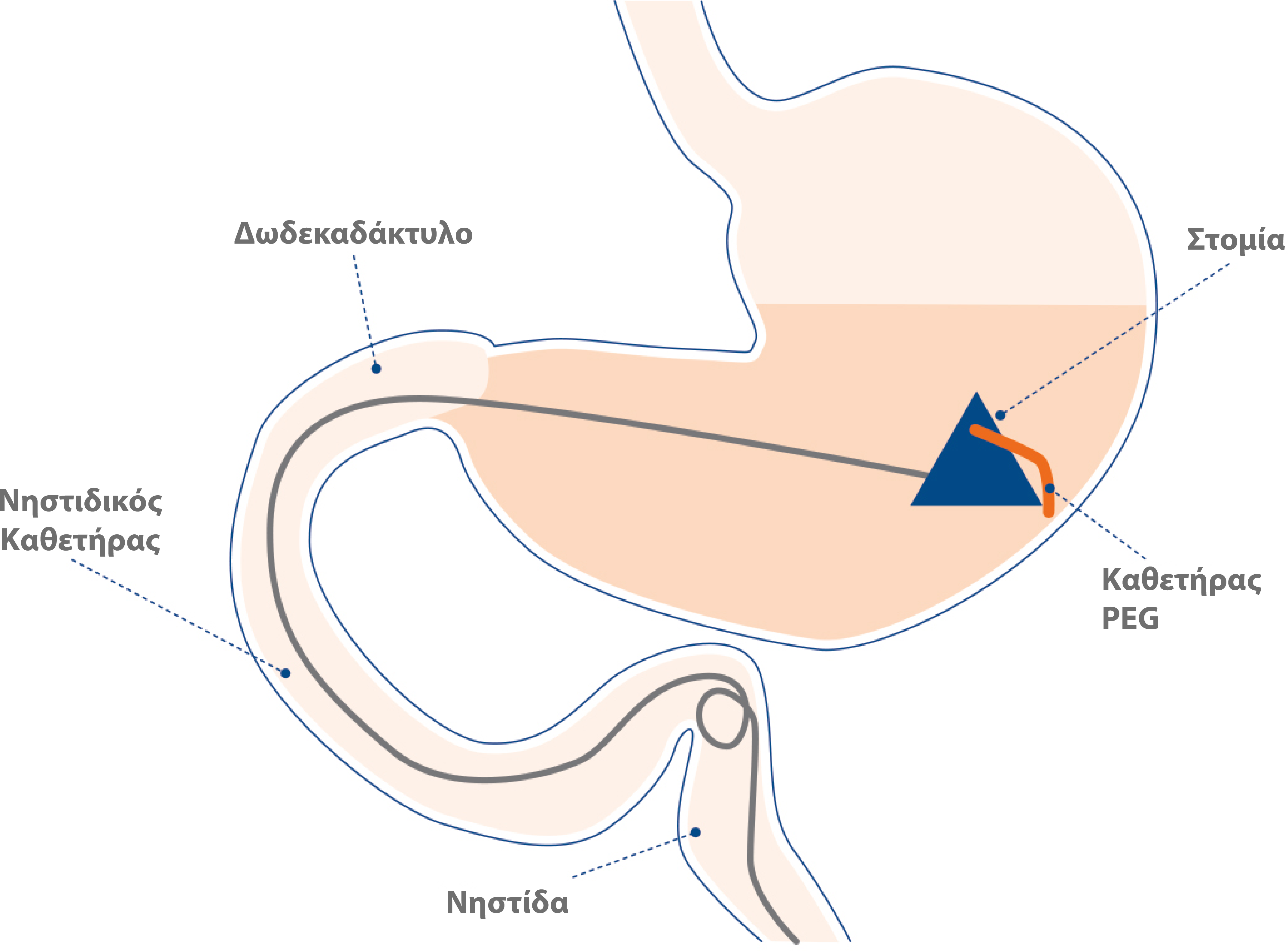 Duodopa_AbbVie_Pro_Graphs31