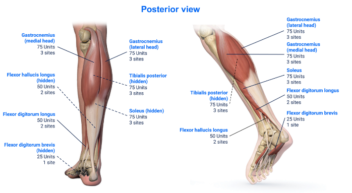 abbvie_pro_neuro_lower_15