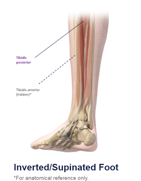 abbvie_pro_neuro_lower_3