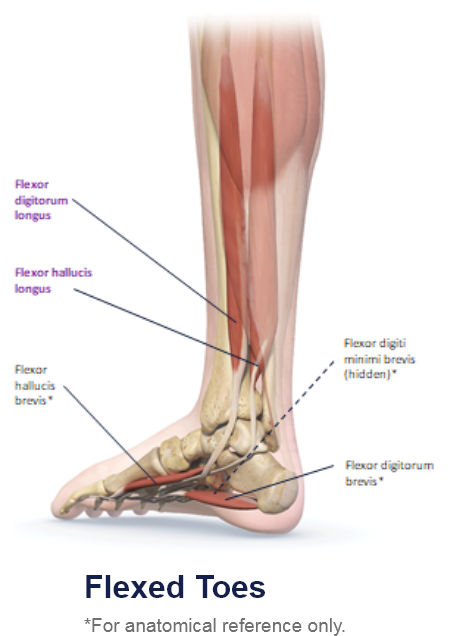 abbvie_pro_neuro_lower_2