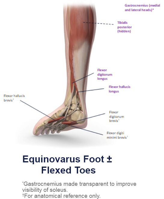 abbvie_pro_neuro_lower_1