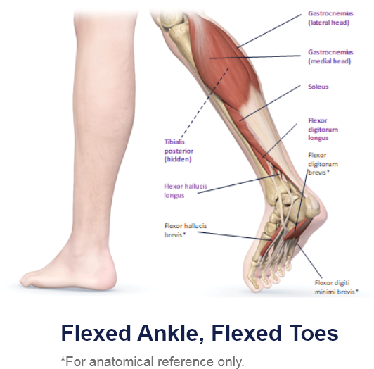 abbvie_pro_neuro_lower_6