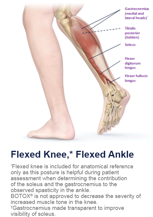 abbvie_pro_neuro_lower_5