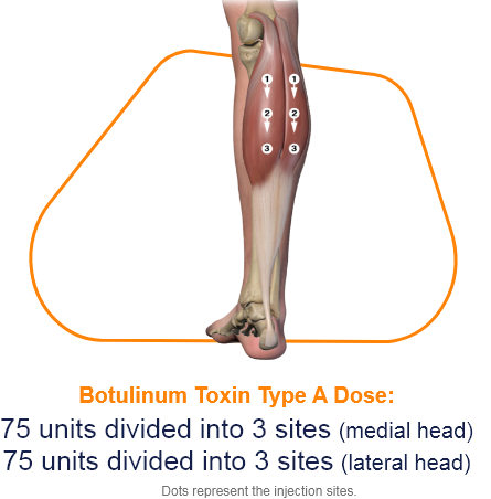 abbvie_pro_neuro_lower_7