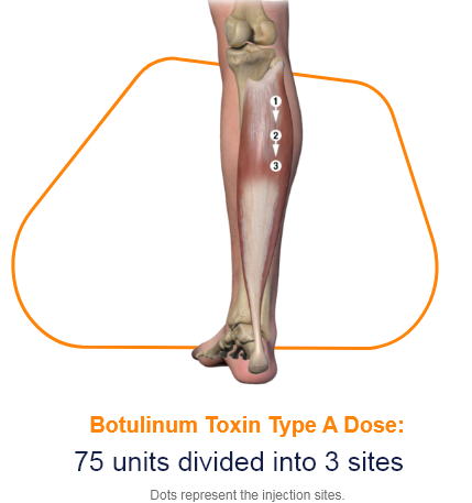 abbvie_pro_neuro_lower_8