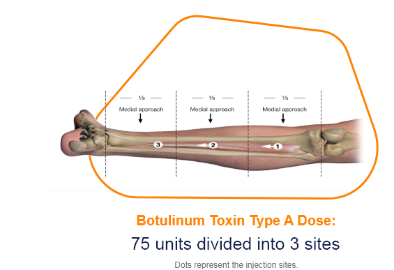abbvie_pro_neuro_lower_9