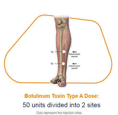 abbvie_pro_neuro_lower_10