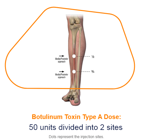 abbvie_pro_neuro_lower_11