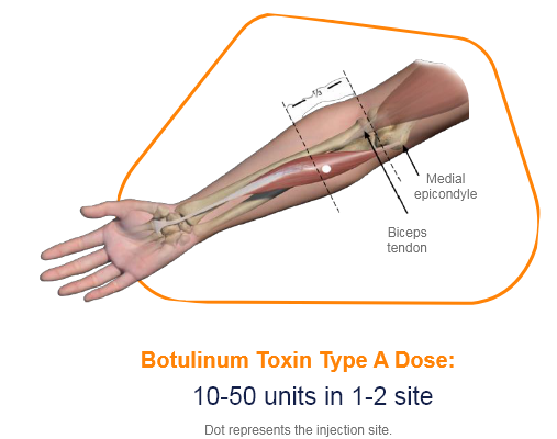 abbvie_pro_neuro_upper_8