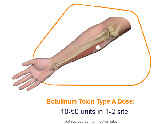 abbvie_pro_neuro_upper_9