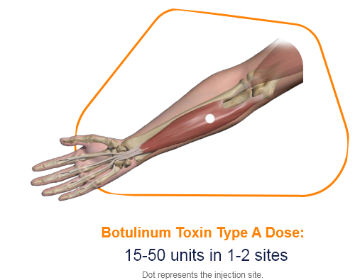 abbvie_pro_neuro_upper_10