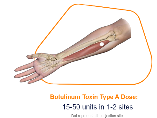 abbvie_pro_neuro_upper_11