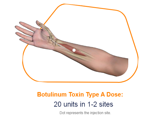 abbvie_pro_neuro_upper_12