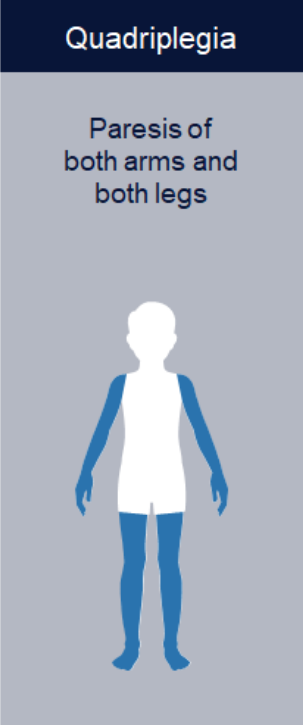 abbvie_pro_neuro_pulsy_5