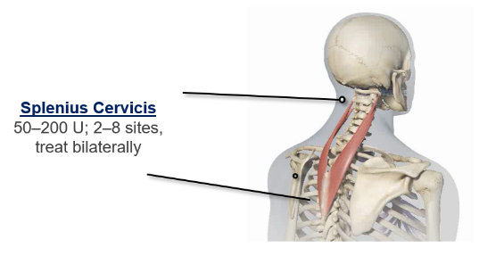 abbvie_pro_neuro_dys_15