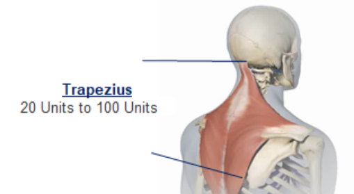 abbvie_pro_neuro_dys_4