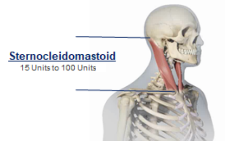 abbvie_pro_neuro_dys_3