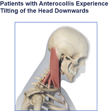 abbvie_pro_neuro_dys_8
