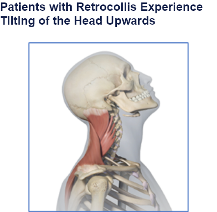 abbvie_pro_neuro_dys_7