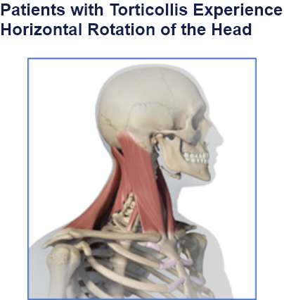 abbvie_pro_neuro_dys_6