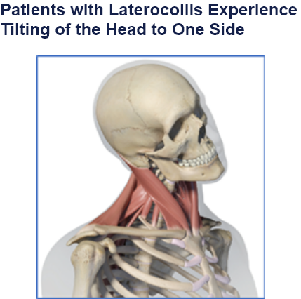 abbvie_pro_neuro_dys_5