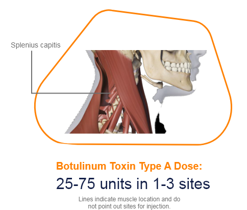 abbvie_pro_neuro_dys_9