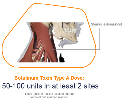 abbvie_pro_neuro_dys_10