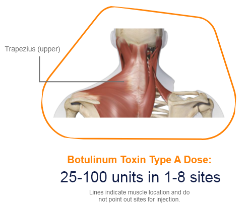 abbvie_pro_neuro_dys_11