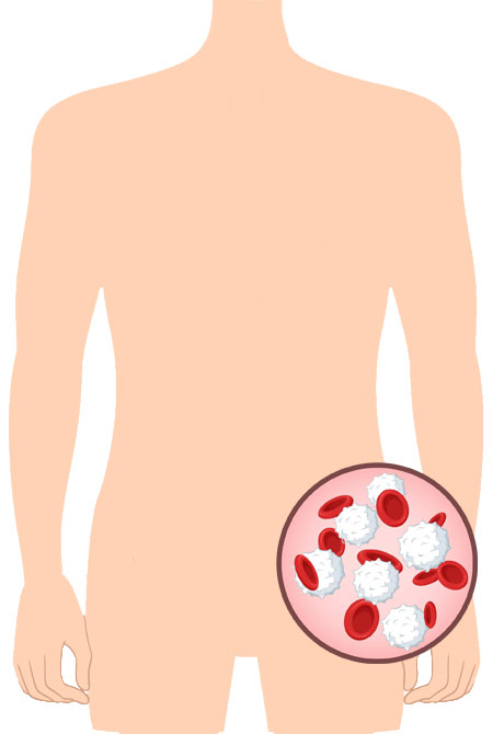 torso umano con illustrazione linfociti