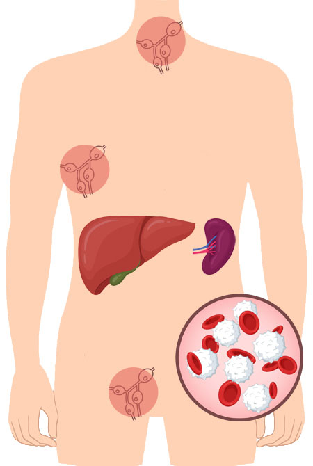torso umano con linfonodi, fegato e milza; illustrazione linfociti