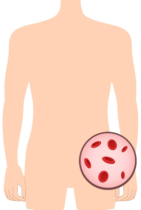 torso umano con illustrazione anemia