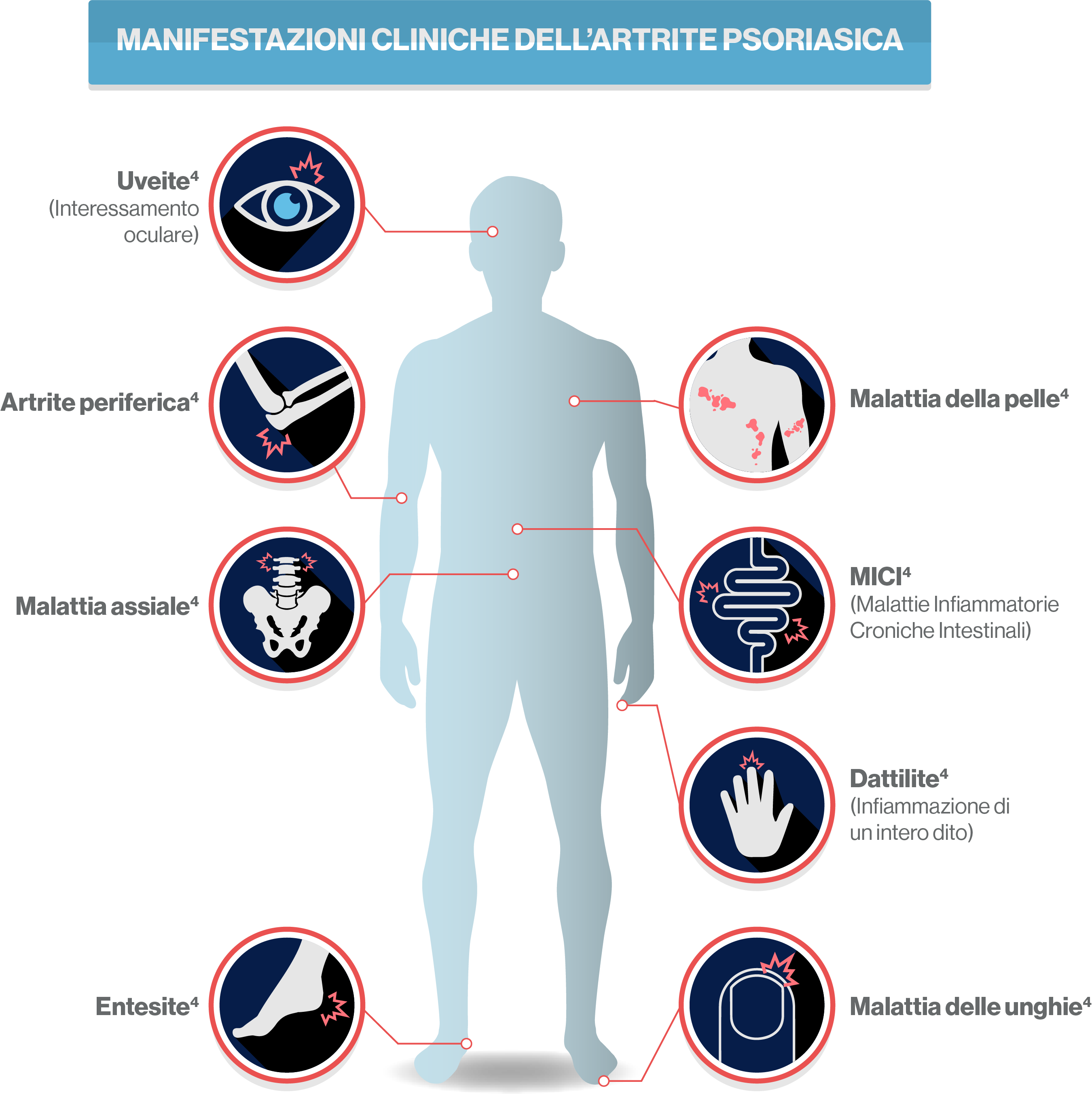 schema manifestazioni cliniche dell'artrite psoriasica