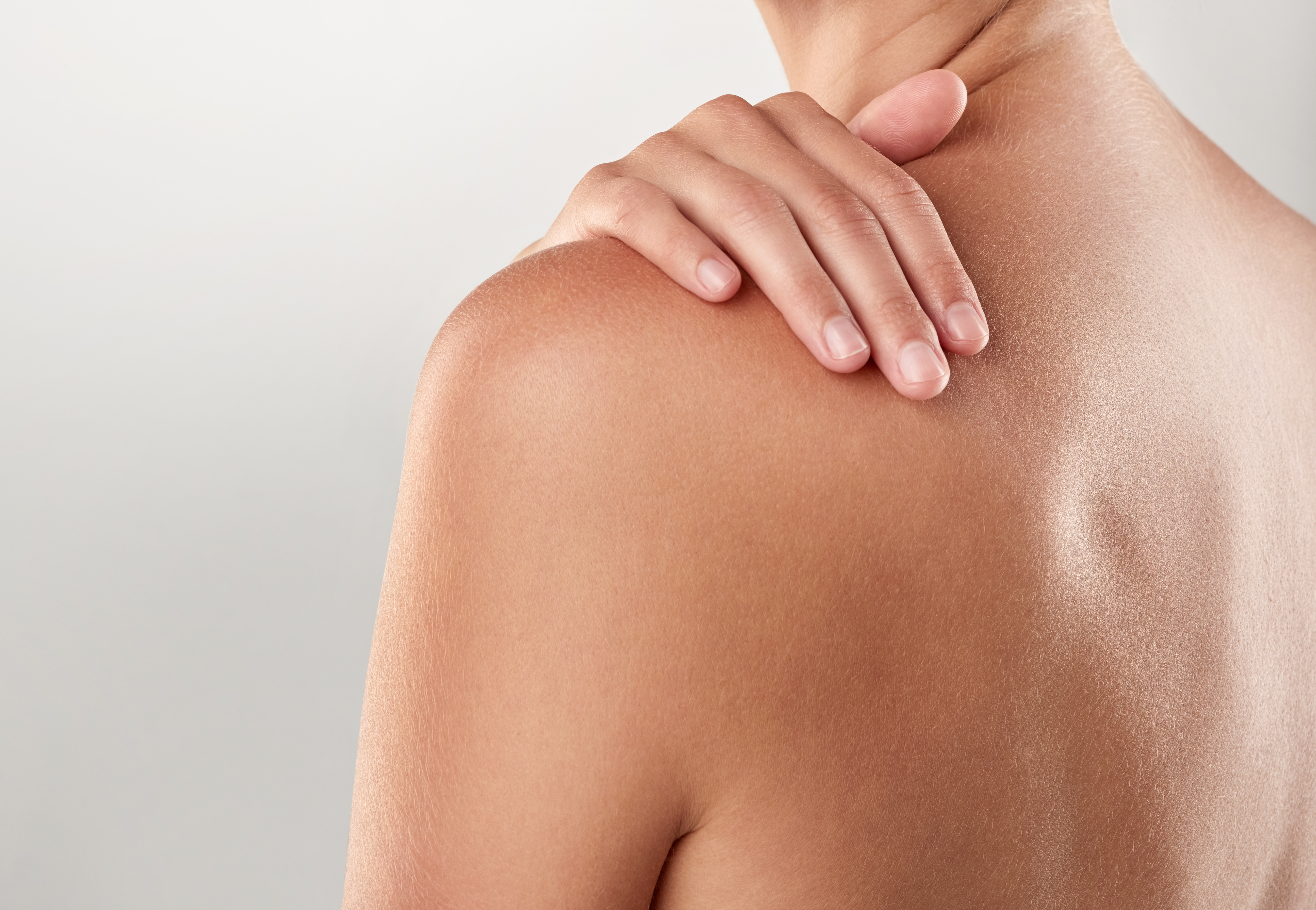 Psoriasis