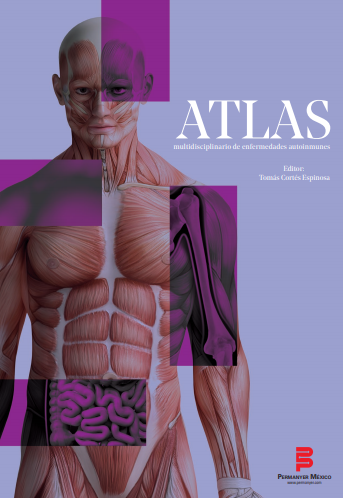 Hidradenitis Supurativa