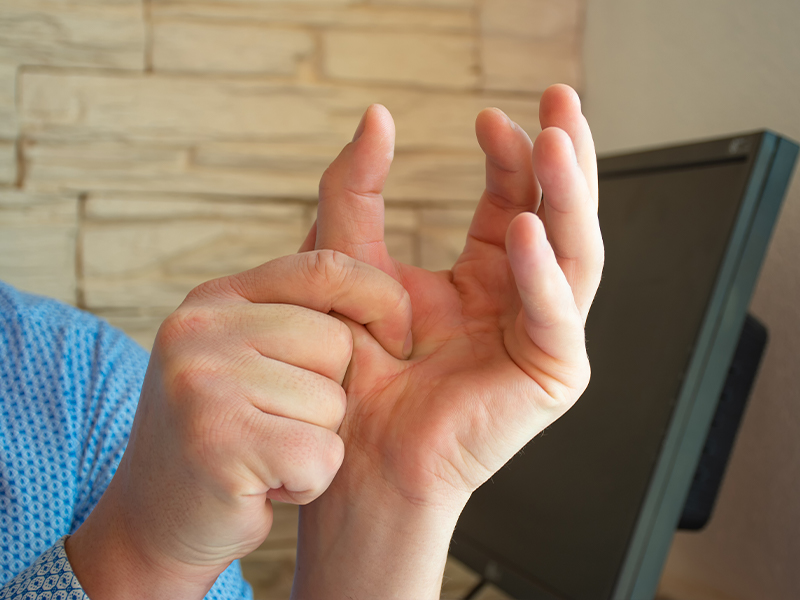 Hidradenitis Supurativa